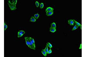 Immunofluorescent analysis of HepG2 cells using ABIN7159976 at dilution of 1:100 and Alexa Fluor 488-congugated AffiniPure Goat Anti-Rabbit IgG(H+L) (ERK2 抗体  (AA 133-316))