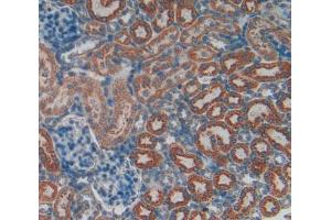 Used in DAB staining on fromalin fixed paraffin-embedded Spleen tissue (VCAM1 抗体  (AA 369-658))