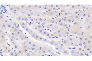 Detection of SDH in Bovine Liver Tissue using Polyclonal Antibody to Sorbitol Dehydrogenase (SDH) (SORD 抗体  (AA 4-344))