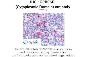 Image no. 1 for anti-G Protein-Coupled Receptor, Family C, Group 5, Member D (GPRC5D) (1st Cytoplasmic Domain) antibody (ABIN1735222) (GPRC5D 抗体  (1st Cytoplasmic Domain))