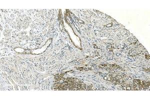 IHC analysis of H Cadherin/CDH13 using anti-H Cadherin/CDH13 antibody (ABIN7600095). (Cadherin 13 抗体  (AA 149-692))