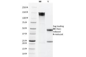 SDS-PAGE Analysis Purified EpCAM Mouse Monoclonal Antibody (PAN-EpCAM). (EpCAM 抗体)