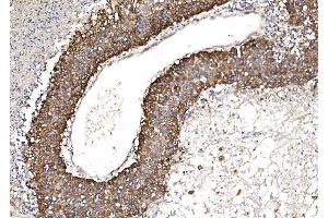 IHC analysis of POR using anti-POR antibody (ABIN7602795).