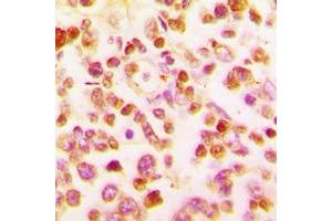 Immunohistochemical analysis of BCL6 staining in human tonsil formalin fixed paraffin embedded tissue section. (BCL6 抗体  (C-Term))
