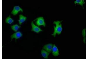 Immunofluorescence staining of A549 cells with ABIN7157890 at 1:50, counter-stained with DAPI. (LAMb4 抗体  (AA 1513-1761))