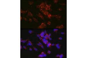 Immunofluorescence (IF) image for anti-L1 Cell Adhesion Molecule (L1CAM) (AA 1143-1257) antibody (ABIN6143053)