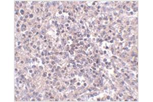 Immunohistochemistry (Paraffin-embedded Sections) (IHC (p)) image for anti-Solute Carrier Family 39 (Zinc Transporter), Member 10 (SLC39A10) (Center) antibody (ABIN783820)
