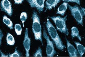Immunofluorescence staining of human endothelial cells. (EIF2AK2 抗体  (AA 117-250))