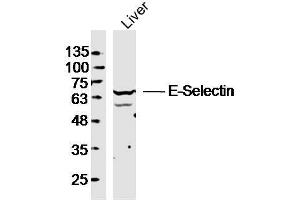 Mouse liver lysates probed with E-selectin Polyclonal Antibody, unconjugated  at 1:300 overnight at 4°C followed by a conjugated secondary antibody at 1:10000 for 90 minutes at 37°C. (Selectin E/CD62e 抗体  (AA 501-612))