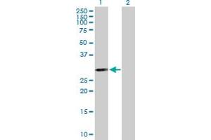 Western Blot analysis of PSMB5 expression in transfected 293T cell line by PSMB5 MaxPab polyclonal antibody. (PSMB5 抗体  (AA 1-263))