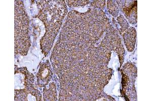IHC analysis of NDUFS2 using anti-NDUFS2 antibody (ABIN7599417).