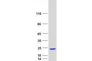 Western Blotting (WB) image for Wilms Tumor 1 Associated Protein (WTAP) (Transcript Variant 2) protein (Myc-DYKDDDDK Tag) (ABIN2735640)