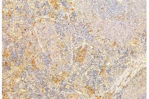 ABIN6264193 and ABIN6269202 at 1/100 staining Rat spleen tissue by IHC-P. (PI3K p85 alpha/gamma 抗体)