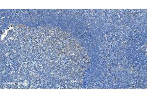 IHC analysis of DRP1/DNM1L using anti-DRP1/DNM1L antibody (ABIN7602180). (Dynamin 1-Like 抗体  (AA 618-736))