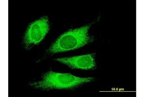 Immunofluorescence of monoclonal antibody to TG on HeLa cell. (Thyroglobulin 抗体  (AA 2659-2768))