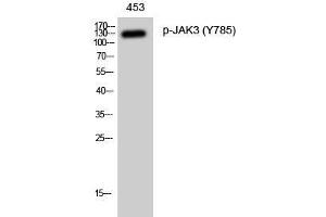 Western Blot analysis of 453 cells with Phospho-JAK3 (Tyr785) Polyclonal Antibody at dilution of 1:1000 (JAK3 抗体  (pTyr785))