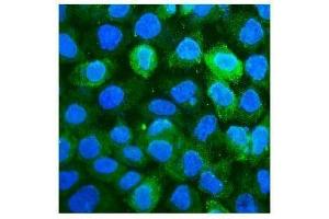 IF analysis of CD59 using anti-CD59 antibody (ABIN7600941). (CD59 抗体  (AA 26-102))