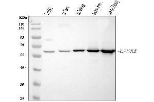 Western blot analysis of EPHX2 using anti-EPHX2 antibody (ABIN4886572). (EPHX2 抗体  (C-Term))
