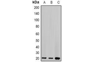 Western Blotting (WB) image for anti-Centrin, EF-Hand Protein, 2 (CETN2) (full length) antibody (ABIN6005128) (CETN2 抗体  (full length))