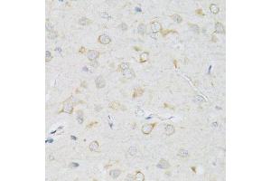 Immunohistochemistry of paraffin-embedded rat brain using SLC2A13 antibody. (SLC2A13 抗体  (AA 564-648))