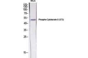 Western Blot (WB) analysis of specific cells using Phospho-Cytokeratin 8 (S73) Polyclonal Antibody. (KRT8 抗体  (pSer73))