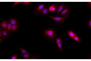 Immunofluorescence analysis of U-2OS cells using BRCA2 Polyclonal Antibody at dilution of 1:100