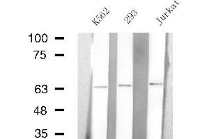 Western blot analysis of extracts from K562/293/Jurkat cells, using ARSE antibody. (Arylsulfatase E 抗体  (Internal Region))