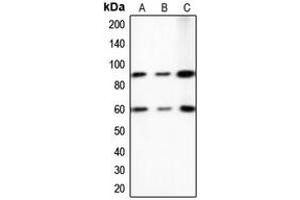 Western blot analysis of PE2 expression in A431 (A), HeLa (B), NIH3T3 (C) whole cell lysates. (ERF 抗体  (C-Term))
