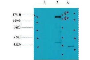 Western Blot (WB) analysis of 1) HeLa, 2) 293, 3) Jurkat, diluted at 1:2000. (ErbB2/Her2 抗体)