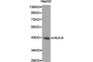 Western Blotting (WB) image for anti-Major Histocompatibility Complex, Class I, A (HLA-A) antibody (ABIN1873024) (HLA-A 抗体)