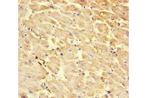 Immunohistochemistry of paraffin-embedded human heart tissue using ABIN7168509 at dilution of 1:100 (RYR2 抗体  (AA 901-1192))