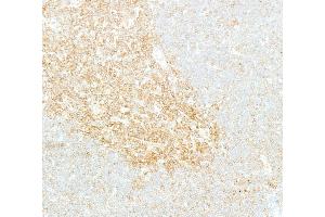 Immunohistochemistry (IHC) image for anti-Nuclear Factor-kB p65 (NFkBP65) (C-Term) antibody (ABIN7795800)