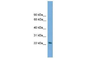 Western Blot showing RAB15 antibody used at a concentration of 1-2 ug/ml to detect its target protein. (RAB15 抗体  (Middle Region))