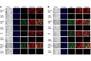 Fluorescence Microscopy (FM) image for anti-Apolipoprotein A-I (APOA1) antibody (ABIN5596808)