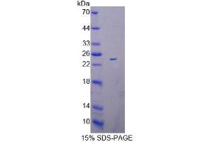 SDS-PAGE analysis of Mouse ACADS Protein. (ACADS 蛋白)