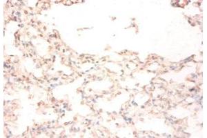 Immunohistochemistry of paraffin-embedded human lung tissue using ABIN7159501 at dilution of 1:50 (STEAP1 抗体  (AA 3-69))