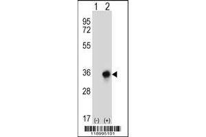 Western blot analysis of CBR3 using rabbit polyclonal CBR3 Antibody using 293 cell lysates (2 ug/lane) either nontransfected (Lane 1) or transiently transfected (Lane 2) with the CBR3 gene. (CBR3 抗体  (C-Term))