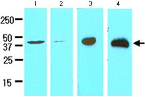 Cell lysates of HeLa (lane 1), MCF-7 (lane 2), LNCaP (lane 3) and mouse brain (lane 4) (30 ug) were resolved by SDS-PAGE and probed with TREM2 monoclonal antibody, clone 2B5  (1:500). (TREM2 抗体  (AA 19-161))