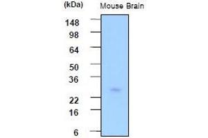 Western Blotting (WB) image for anti-Phosphoserine Phosphatase (PSPH) (AA 1-225), (N-Term) antibody (ABIN317527) (PSPH 抗体  (N-Term))