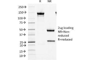 SDS-PAGE Analysis Purified MCM7 Mouse Monoclonal Antibody (MCM7/1466). (MCM7 抗体  (AA 195-319))