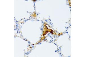 Immunohistochemistry of paraffin-embedded mouse lung using CTRB1 antibody (ABIN7266398) at dilution of 1:100 (40x lens). (CTRB1 抗体  (AA 79-263))