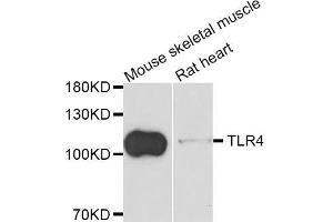 Western blot analysis of extracts of mouse skeletal muscle and rat heart cell lines, using TLR4 antibody. (TLR4 抗体)