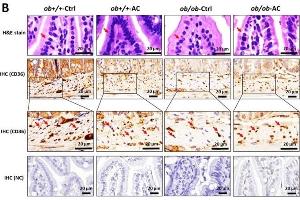 The intestinal barrier is maintained by AC in ob/ob mice.