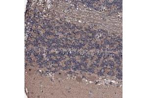 Immunohistochemical staining of human cerebellum with SUPT7L polyclonal antibody  shows distinct nucleolar positivity in purkinje cells at 1:200-1:500 dilution. (SUPT7L 抗体)