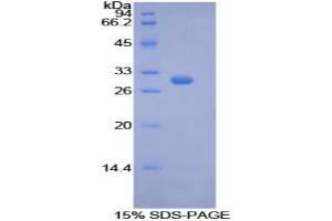 SDS-PAGE analysis of Human PCK1 Protein. (PCK1 Protein (Soluble))