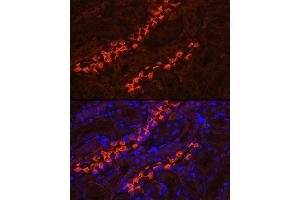 Immunofluorescence analysis of rat kidney using V1B1 Rabbit pAb (ABIN6131094, ABIN6137346, ABIN6137347 and ABIN6222603) at dilution of 1:200 (40x lens).
