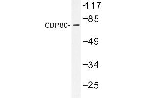 Image no. 1 for anti-Nuclear Cap Binding Protein Subunit 1, 80kDa (NCBP1) antibody (ABIN272218) (NCBP1 抗体)