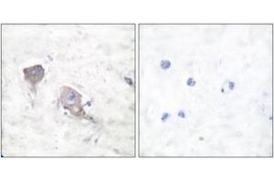 Immunohistochemistry analysis of paraffin-embedded human brain tissue, using SNAP25 Antibody. (SNAP25 抗体  (AA 151-200))