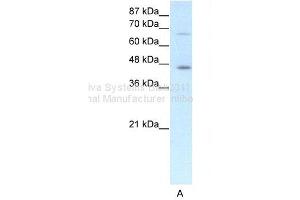 WB Suggested Anti-ESR2 Antibody Titration: 1. (ESR2 抗体  (N-Term))