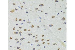 Immunohistochemistry (Paraffin-embedded Sections) (IHC (p)) image for anti-Dicer 1, Ribonuclease Type III (DICER1) antibody (ABIN7010921)